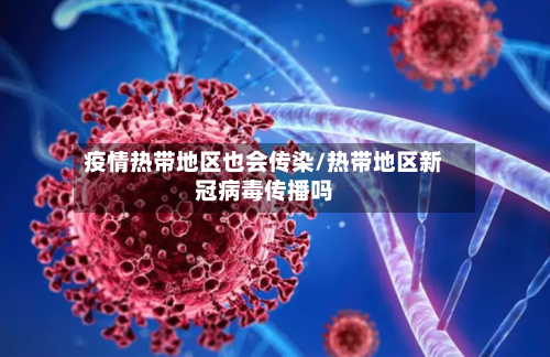 疫情热带地区也会传染/热带地区新冠病毒传播吗