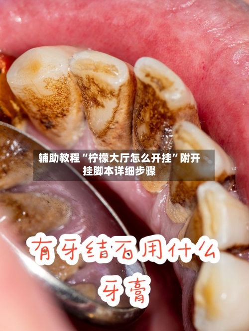 辅助教程“柠檬大厅怎么开挂	”附开挂脚本详细步骤-第2张图片