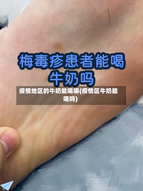 疫情地区的牛奶能喝嘛(疫情区牛奶能喝吗)-第2张图片